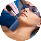 Laser hair removal vs epilators